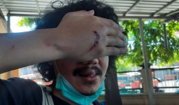 Polisi Buru Pelaku Pengeroyokan Editor detikcom