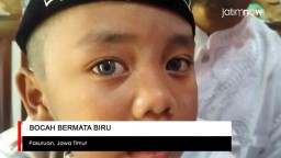 Video: Bocah Bermata Biru dari Pasuruan