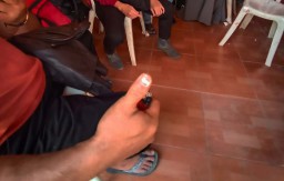 Makna di Balik Tanda Khusus Pada Kuku Pasien Ningsih Tinampi