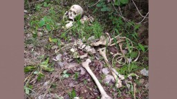 Geger! Warga Temukan Tengkorak dan Tulang Manusia di Lahan Perhutani