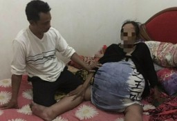 Penderita Tumor Ganas di Malang Akhirnya Dirawat di Rumah Sakit