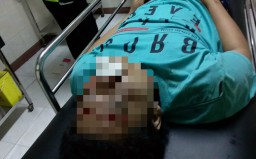 Perbaikan Jalan di Ponorogo 'Makan' Korban, Seorang Biker Tewas