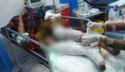 Polisi: Peracik Petasan yang Meledak di SDN Probolinggo Bisa Tersangka