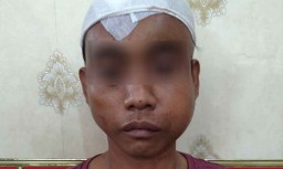 Duel dengan Korban, Seorang Pembegal Motor di Surabaya Dibekuk