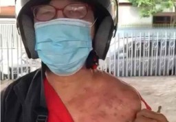 Viral Video Perempuan Mengaku Terkena Semprot Mobil PMK Surabaya