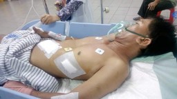 Duel Lawan Bandit Motor, Warga Surabaya Terkapar Dibacok Pelaku 