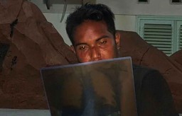 Dikeroyok Sesama Suporter, Korban: Saya Harap Aremania Lebih Bijak