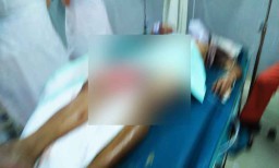 Tegur Tetangga Matikan Mesin Motor Dalam Gang, Pria ini Malah Dibacok