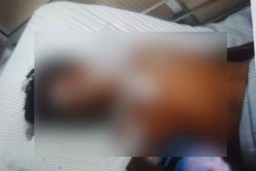 Telan Kail Pancing, Pemuda di Banyuwangi ini Terluka Parah