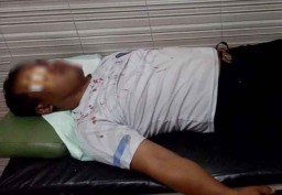 Begini Luka Polisi Lamongan yang Diserang dengan Ketapel