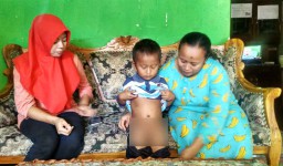 Bocah di Probolinggo ini Dipercaya Disunat Jin