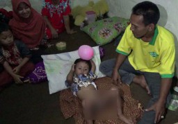 Heboh! Bocah 4 Tahun ini Disunat Makhluk Astral