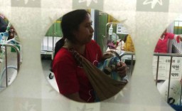 RSU dr Soetomo Tangani Pasien Bayi dengan Penyakit Langka