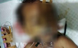 Bermain di Pemandian Pancoran, Dua Bocah di Banyuwangi Tertimpa Pohon 