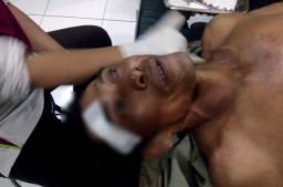 Polisi Tunggu Hasil Tes Kejiwaan Pelaku Pembacokan di Pasuruan